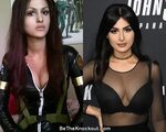 SSSniperwolf Plastic Surgery Comparison Photos